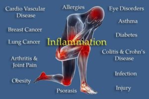 How to reverse inflammation in the body Dr. Vincent M. Pedre