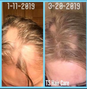 How I Got Incredible Results With My Hair Care